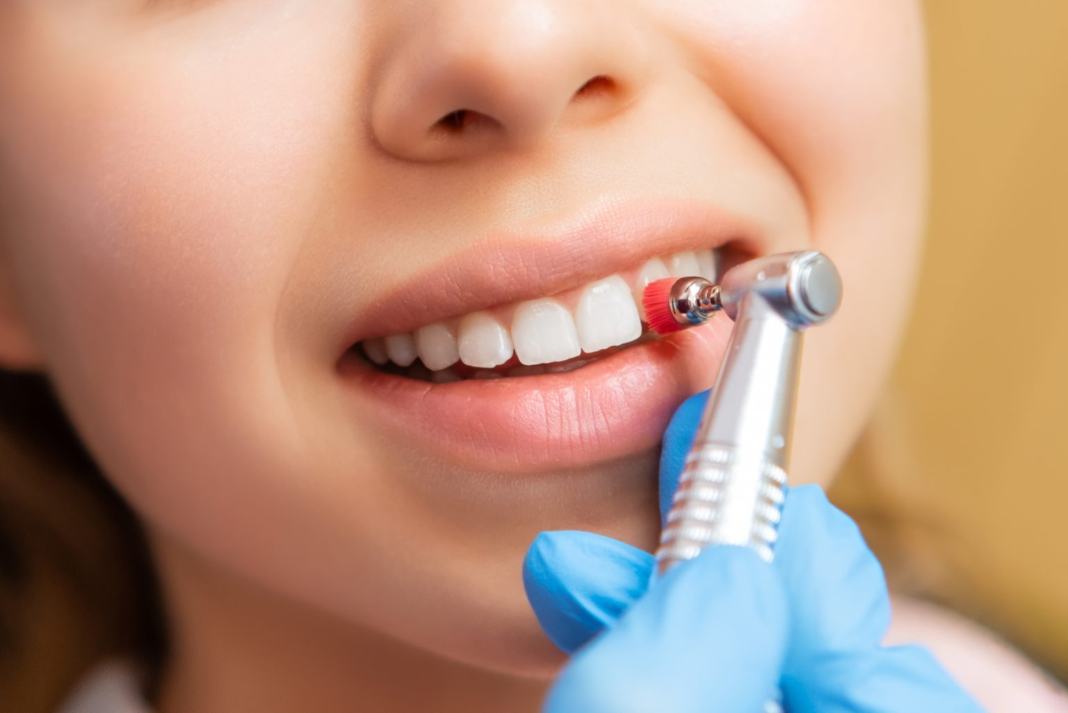 Профессиональная чистка зубов professional cleaning teeth